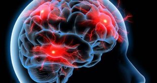 منظم غذا خوردن مانع زوال عقل--