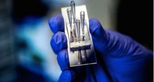 کلیه الکترونیکی